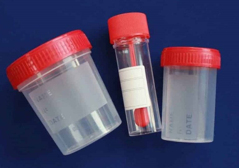 Можно ли, как и сколько хранить анализы в холодильнике